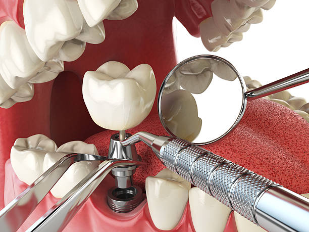 Best Mobile Emergency Dentist in Powell, TN